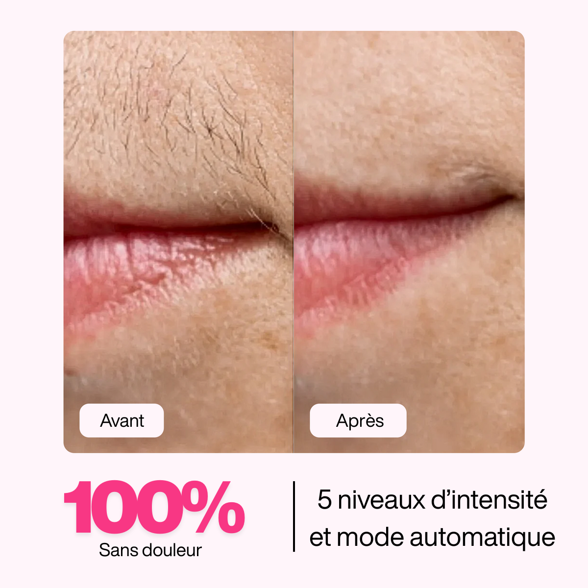 Épilateur à lumière pulsée Paris