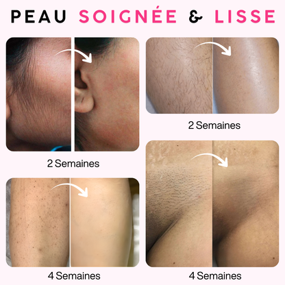 Épilateur à lumière pulsée Paris