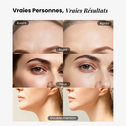 Brosse lymphatique pour le visage