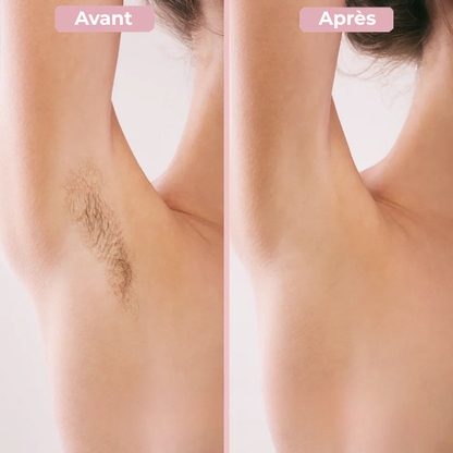 Épilisse - Rasoir corporel 2-en-1 pour femmes