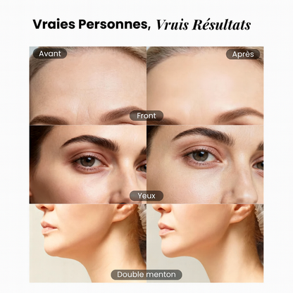 Brosse lymphatique pour le visage